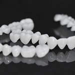 Zahnschienen – Weiße, natürliche Optik – Perfekte Passform – Für strahlendes Lächeln
