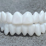 Zahnschienen – Weiße, natürliche Optik – Perfekte Passform – Für strahlendes Lächeln